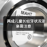 两成儿童长蛀牙状况紧急需注意(图2) 两成儿童长蛀牙状况紧急需注意(图2)