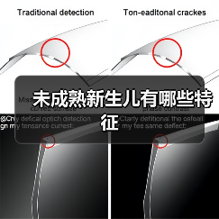 未成熟新生儿有哪些特征(图3) 未成熟新生儿有哪些特征(图3)
