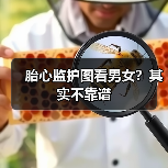 胎心监护图看男女？其实不靠谱（图4）