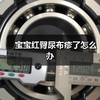 宝宝红臀尿布疹了怎么办（图1）