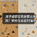 孩子感冒是否需要去医院?轻症在家应对指南(图3) 孩子感冒是否需要去医院?轻症在家应对指南(图3)