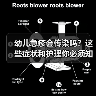幼儿急疹会传染吗?这些症状和护理你必须知道(图3) 幼儿急疹会传染吗?这些症状和护理你必须知道(图3)