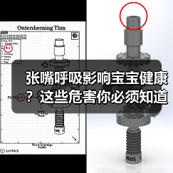张嘴呼吸影响宝宝健康?这些危害你必须知道(图2) 张嘴呼吸影响宝宝健康?这些危害你必须知道(图2)