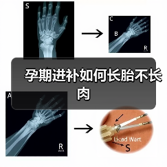 孕期进补如何长胎不长肉(图1) 孕期进补如何长胎不长肉(图1)